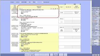 Electronic Medication Administration Record [upl. by Notle497]