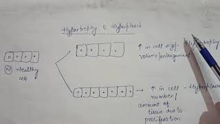 Definition of Hypertrophy and Hyperplasia Learn in easy way 💯 u will remember [upl. by Hnamik184]