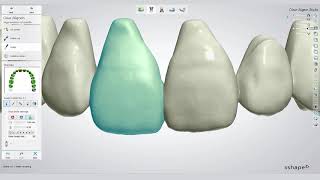 3Shape Clear Aligner Studio workflow with Bernhard Egger [upl. by Clare419]