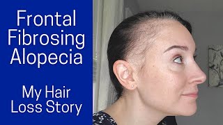 Frontal Fibrosing Alopecia  My Symptoms Diagnosis Treatments [upl. by Nagyam]