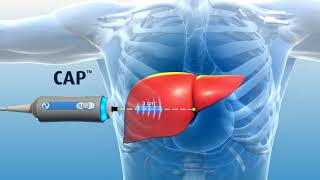 Liver Explained Function Pathology Diseases amp Cirrhosis [upl. by Skye389]