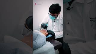 Reveal Radiant Skin with Dermapen Microneedling  PRP [upl. by Norman885]