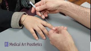 Silicone Finger Prosthesis demonstrating ease of use [upl. by Gottuard911]