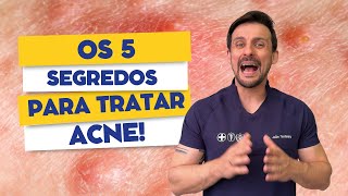 Os 5 segredos para tratar acne  Dr João Tassinary [upl. by Cida]