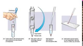 What is Karyotyping [upl. by Kenny]