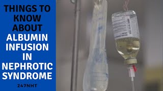 Things to know about albumin infusion in nephrotic syndrome How do you administer albumin infusion [upl. by Anirec]