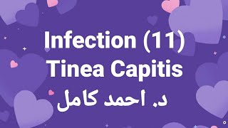 11 Tinea Capitis 👉 Fungal Infection by Dr Ahmed Kamel [upl. by Hsara]