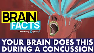 What happens to your brain during a concussion  Brain Facts shorts [upl. by Nomad]