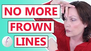 How to Remove Frown Lines Naturally [upl. by Gaskins989]