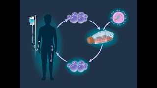 LentiGlobin for Sickle Cell Disease  NEJM [upl. by Whit]