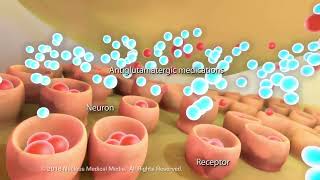 Plaque Formation in the Alzheimers Brain [upl. by Dorothy]