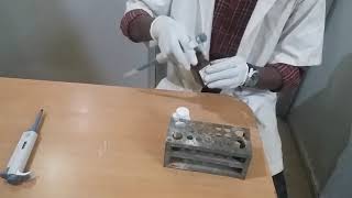 Kidney Function Test KFT [upl. by Elwina]