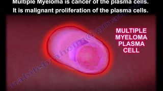 What Patients Need To Know About Multiple Myeloma [upl. by Yung]