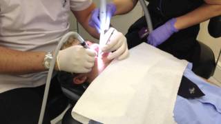 dentist injection drill and filling [upl. by Yardley489]