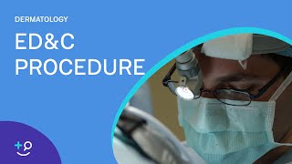 EDampC Procedure Overview Dermatology [upl. by Klatt223]