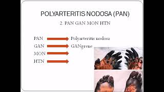 Polyarteritis Nodosa Microscopic Polyangitis amp HSP  VASCULITIS  PATHOLOGY SKY MEDICAL MNEMONICS [upl. by Niall561]