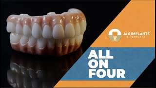 All On 4 Dental Implants What You Should Know and Cost [upl. by Feil]