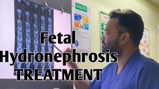 Fetal Hydronephrosis in Pregnancy Treatment  Pregnancy me Bach ki kidney me sujan ka ilaj in hindi [upl. by Rosabelle]