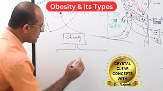 Obesity amp its types  Overweight Causes amp Symptoms [upl. by Baxter]