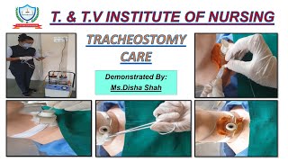 Tracheostomy care [upl. by Mercorr]