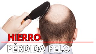 HIERRO ALOPECIA y SUPLEMENTACIÓN explicado por MÉDICO [upl. by Iclek]