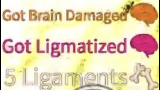 How to get Ligmatized on Broken Bones IV Easy [upl. by Oniratac]