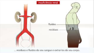 Doença renal  Causas e tratamento [upl. by Massingill778]