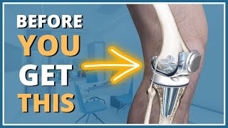 5 things you MUST know before getting a knee replacement [upl. by Atims]