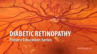 Demystifying Retinal Diseases [upl. by Dun]