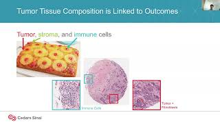 Spatial Biology of Tumor Microenvironments for Clinical Biomarker Development and Therapy Prediction [upl. by Irish]