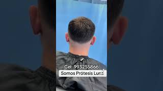 Prótesis capilar cabello humano natural para hombre indetectable  Prótesis Luna Peru [upl. by Crissy]