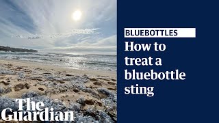 What to do if you get stung by a bluebottle explained by a lifesaver [upl. by Anyaled434]