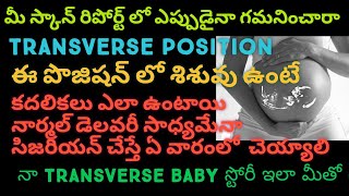 Transverse position during pregnancy transversebaby [upl. by Sheffy]