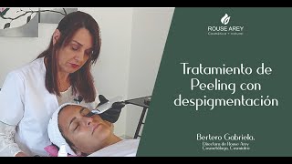 Peeling con espátula ultrasónica DESPIGMENTACIÓN [upl. by Jerrold]