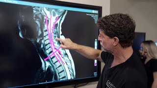 Symptoms of Cervical Stenosis  Jeffrey Cantor MD [upl. by Blanding]