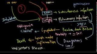 Bacillus anthracis infection [upl. by Nnaerb]