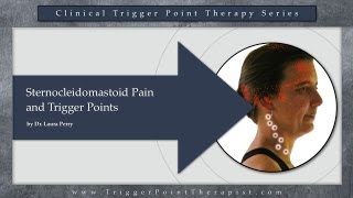 Sternocleidomastoid SCM Pain and Trigger Points [upl. by Yenaled]