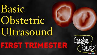 Basic Obstetric Ultrasound First Trimester Pregnancy [upl. by Eliseo]