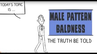 Male Pattern Baldness  Truth Be Told [upl. by Ntsuj]