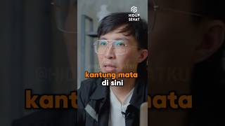 Menghilangkan kantung mata 😩  dr Tirta tipssehat tips doktertirta drtirta tipshidupsehat [upl. by Ttnerb596]