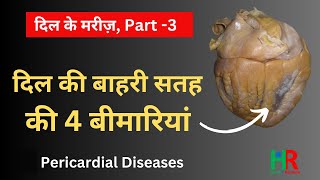 4 types of Pericardial diseases complete information in hindi to prevent heart attack [upl. by Lorri]