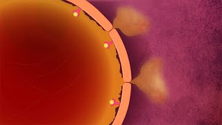 Plasma Leakage [upl. by Mellman]