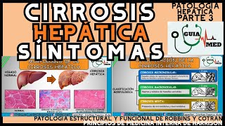 CIRROSIS HEPÁTICA SÍNTOMAS  GuiaMed [upl. by Phillane]