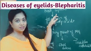 Diseases of eyelids Blepharitis [upl. by Boyd]