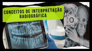 Interpretação Radiográfica Com Diagnósticos [upl. by Nwahsem]