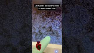 Kalp hücrelerini gördünüz mü heartcell kalphücresi cardiomyocyte [upl. by Asira]