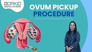 IVF Treatment Ovum Pickup Procedure Egg Collection Treatment in Vapi Valsad Navsari Surat [upl. by Opportuna232]