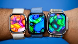 Apple Watch SE  Как выбрать размер 40 или 44 мм опыт использования [upl. by Struve]