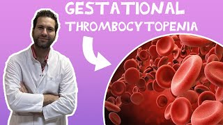 GESTATIONAL THROMBOCYTOPENIA  Pregnancy Health [upl. by Neved]