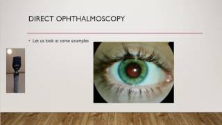 How to do fundoscopy A direct ophthalmoscopy OSCE [upl. by Alyar513]